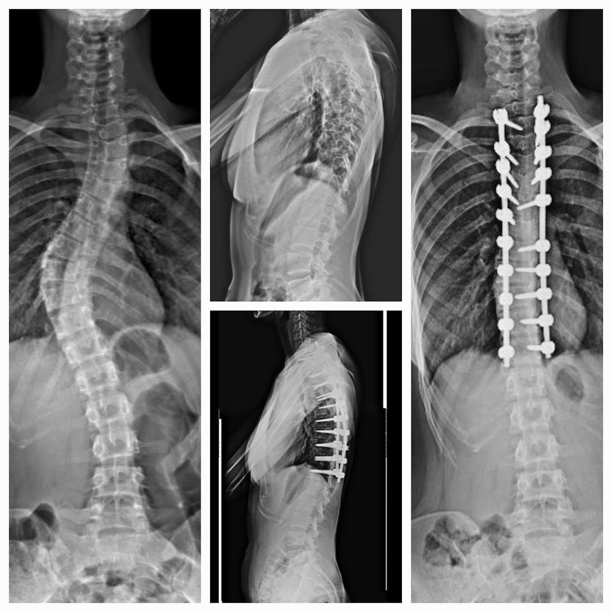 Doç. Dr. Hanifi Üçpunar - Bursa Ortopedi Doktoru — Dr.Visor photo 3