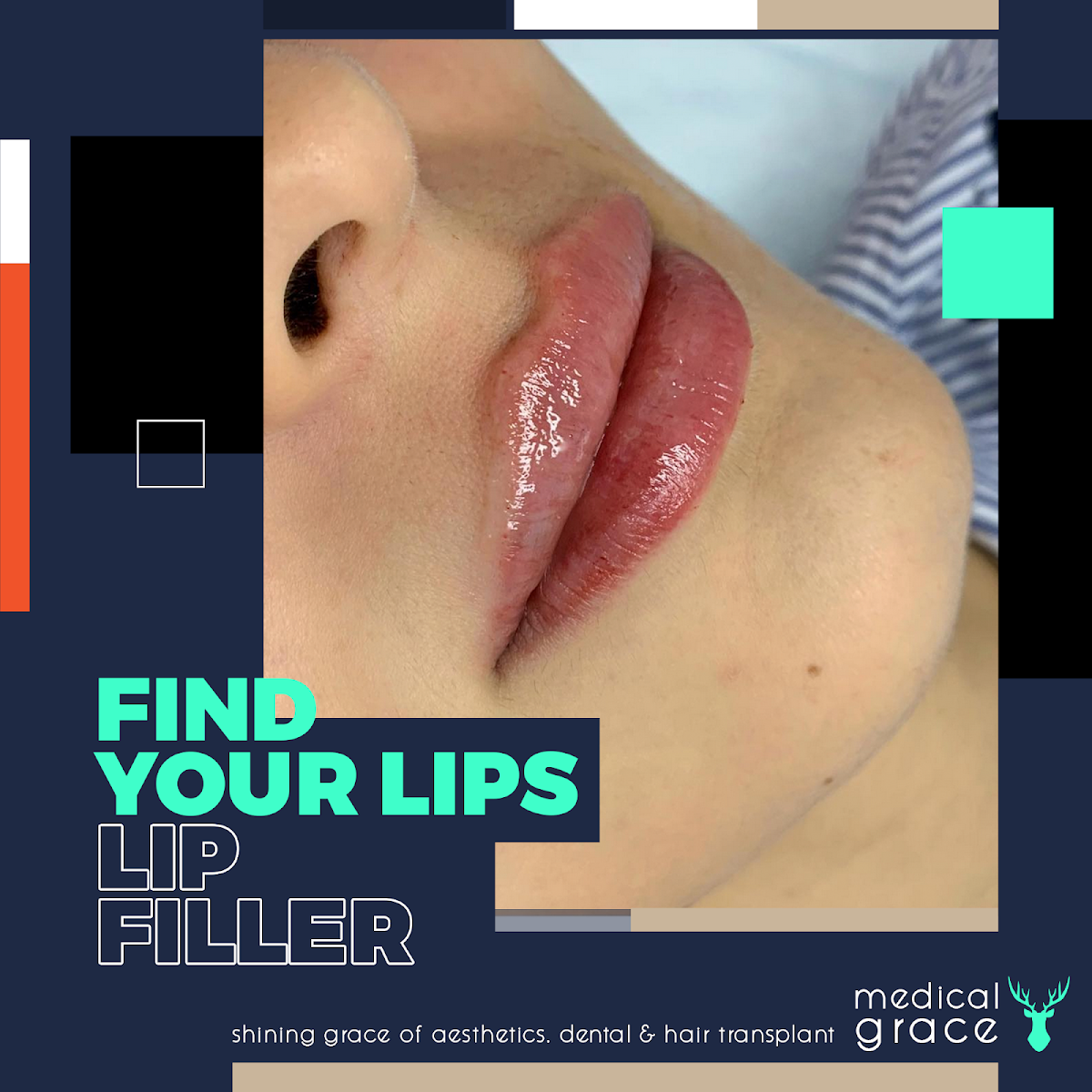 Medical Grace Bodrum Aesthetics — Dr.Visor photo 3