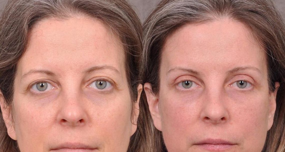 Vivid Clinic | Cosmetic Surgery Istanbul, Turkey — Dr.Visor photo 4