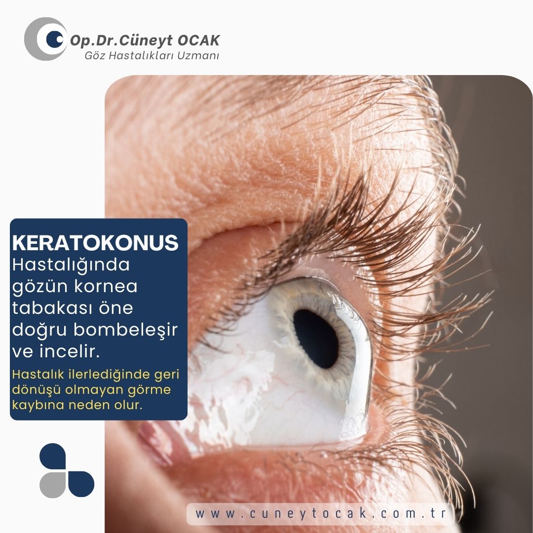 Op. Dr. Cüneyt Ocak — Dr.Visor photo 3