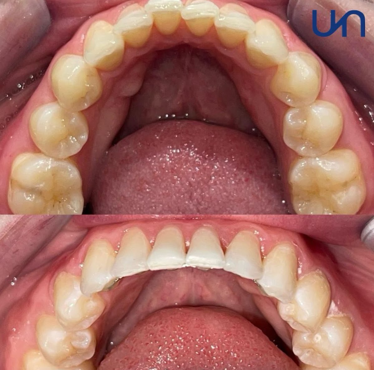 Unique Dental Dublin — Dr.Visor photo 3