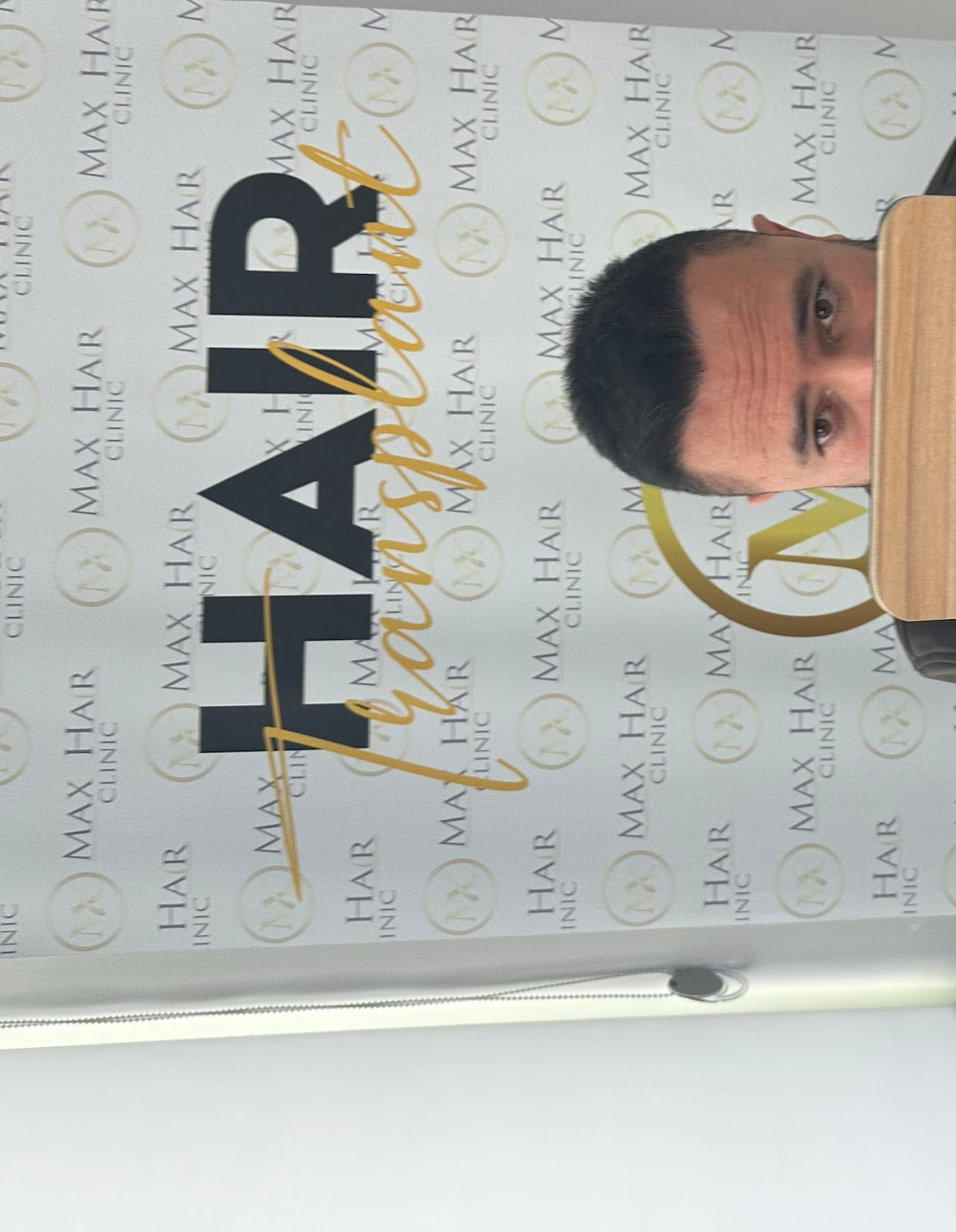 İzmir saç ekim merkezi maxhairclinic / maxhairizmir/saç ekim İzmir — Dr.Visor photo 5