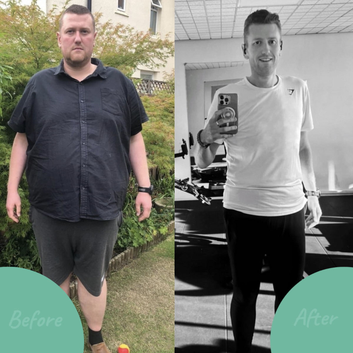 Tonic Weight Loss Surgery — Dr.Visor photo 3