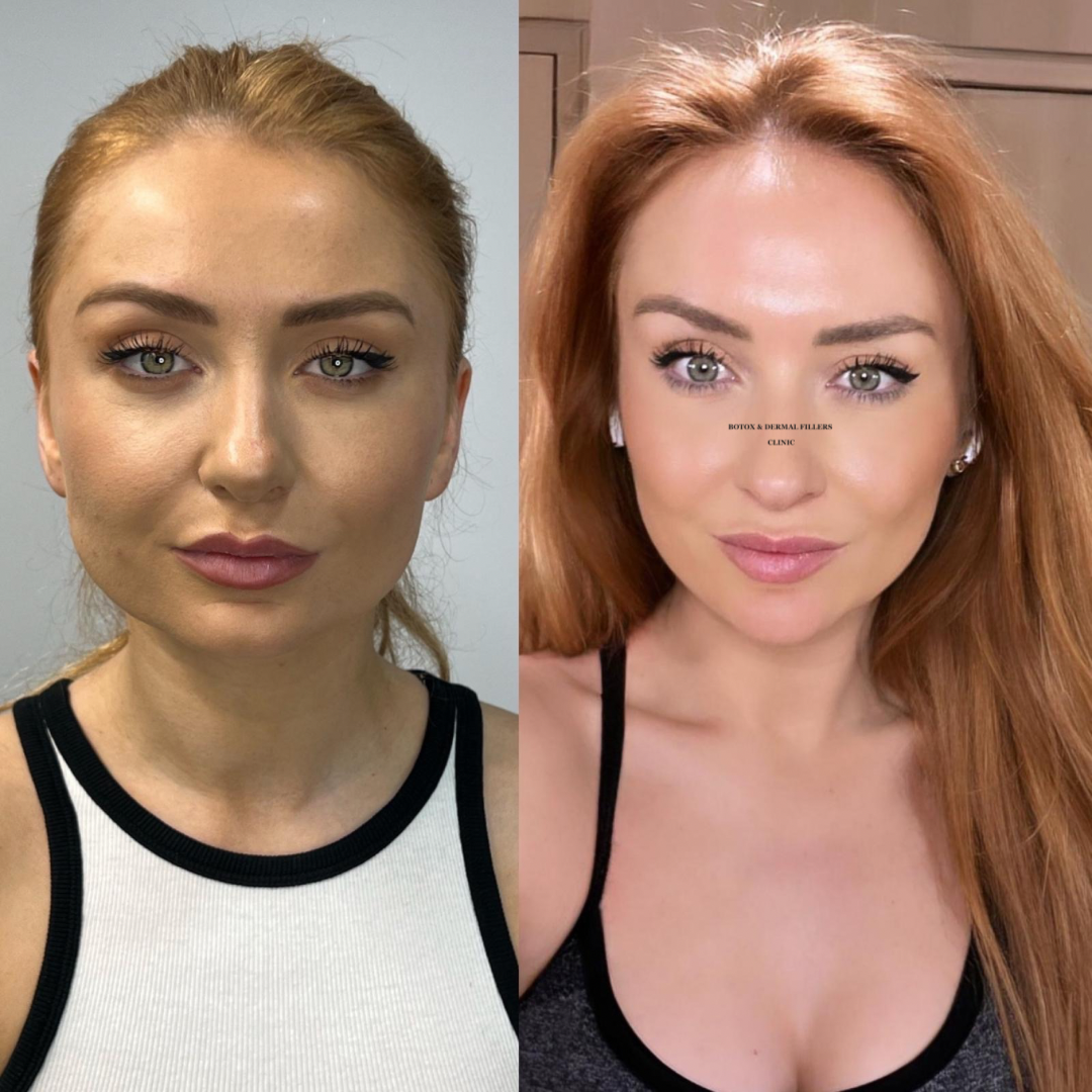 Aesthetics Clinic London — Dr.Visor photo 5