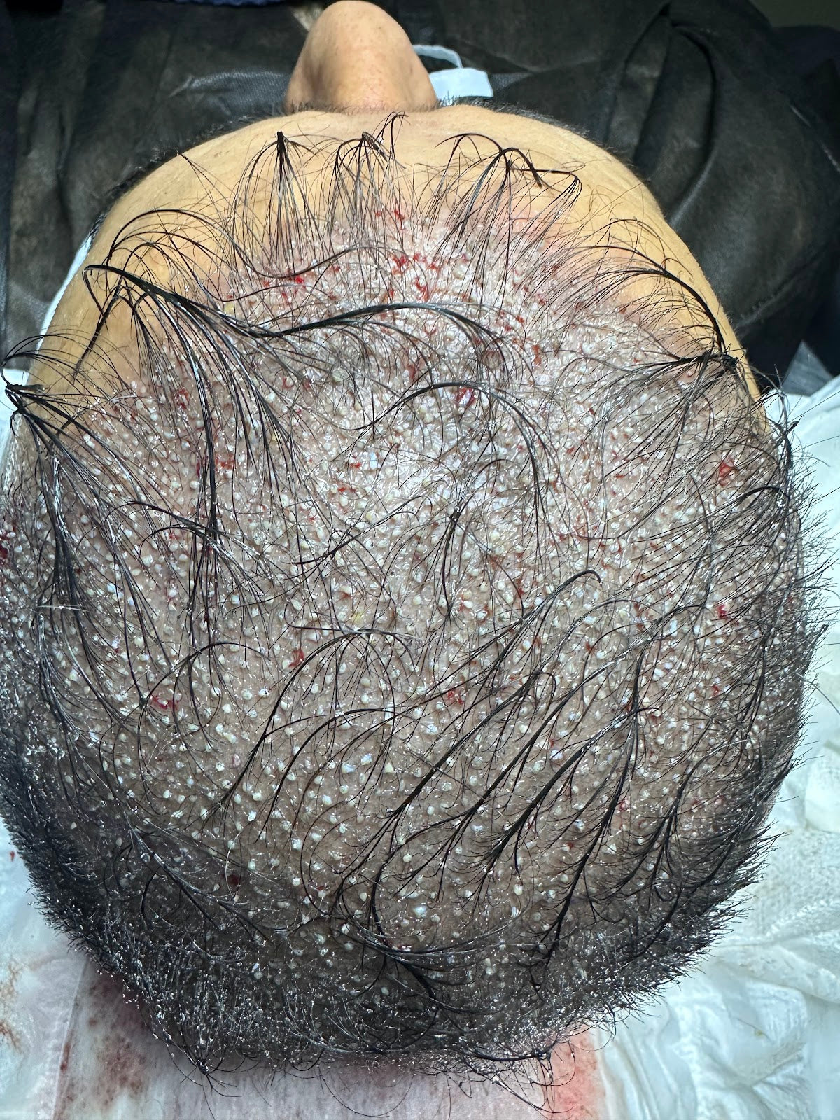Hair Center Saç Ekim Merkezi — Dr.Visor photo 5