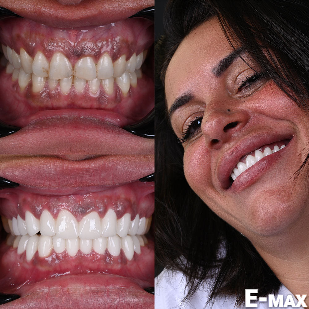 Best Dentist Istanbul | Dental | Hair Transplant | Hospital — Dr.Visor photo 4