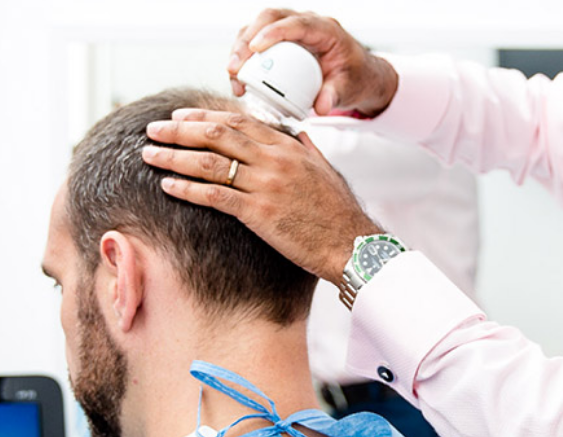 Beacon Hair Restoration Clinic — Dr.Visor photo 3