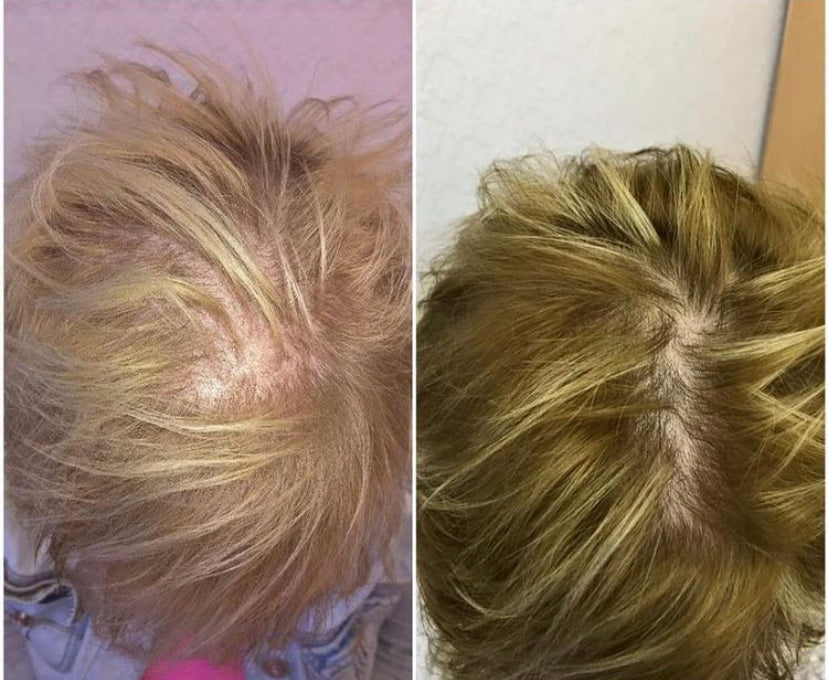 Birmingham Hair Clinic — Dr.Visor
