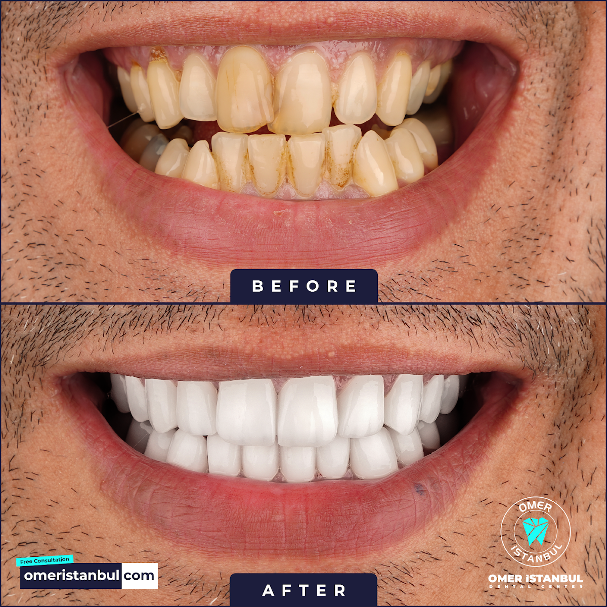 Omer Istanbul Dental Clinic Turkey — Dr.Visor photo 2