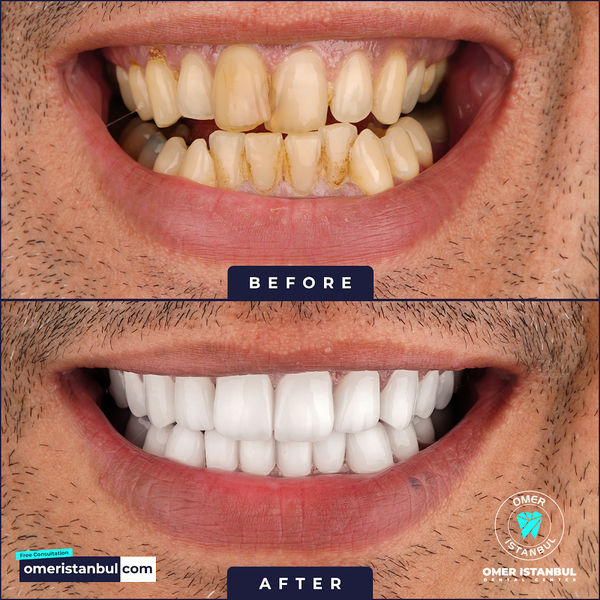 Omer Istanbul Dental Clinic Turkey