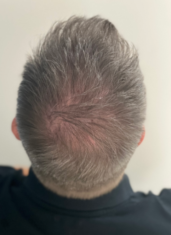 Growclub — Dr.Visor photo 2