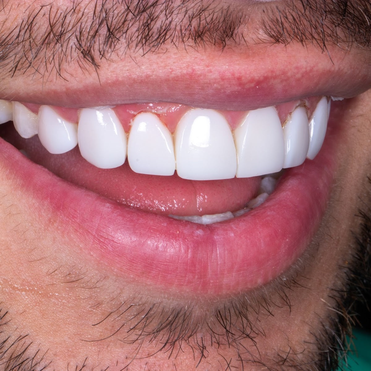 KissDental Manchester — Dr.Visor photo 4