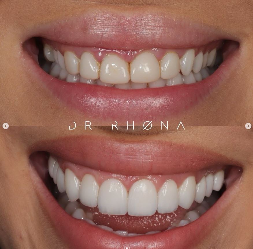 Chelsea Dental Clinic — Dr.Visor photo 3
