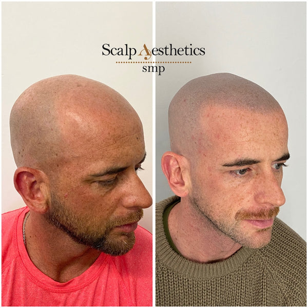 Scalp Aesthetics smp