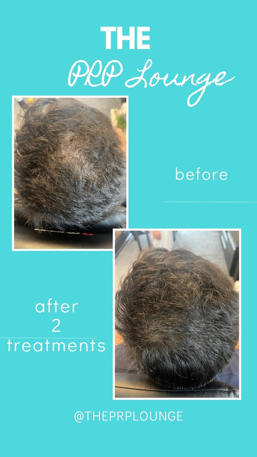 THE PRP LOUNGE - HAIR & SKIN TREATMENT BIRMINGHAM — Dr.Visor photo 3