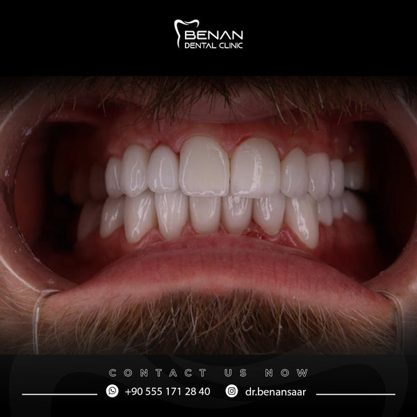 Benan Dental Clinic