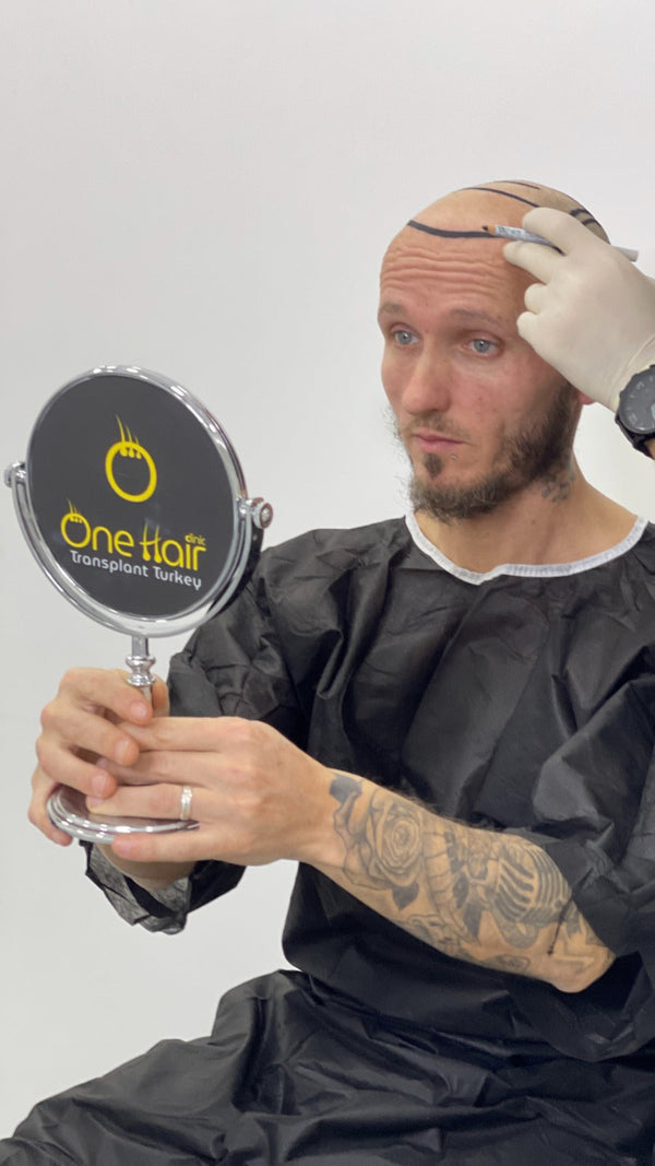 One Hair Clinic Transplantation - Plastic Esthetic