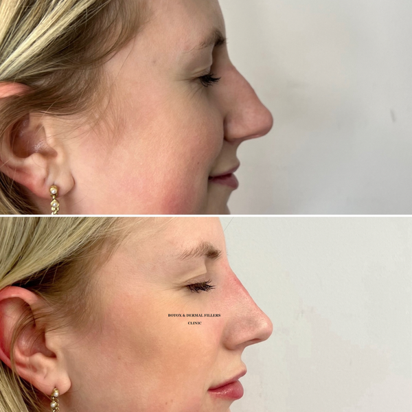 Aesthetics Clinic London
