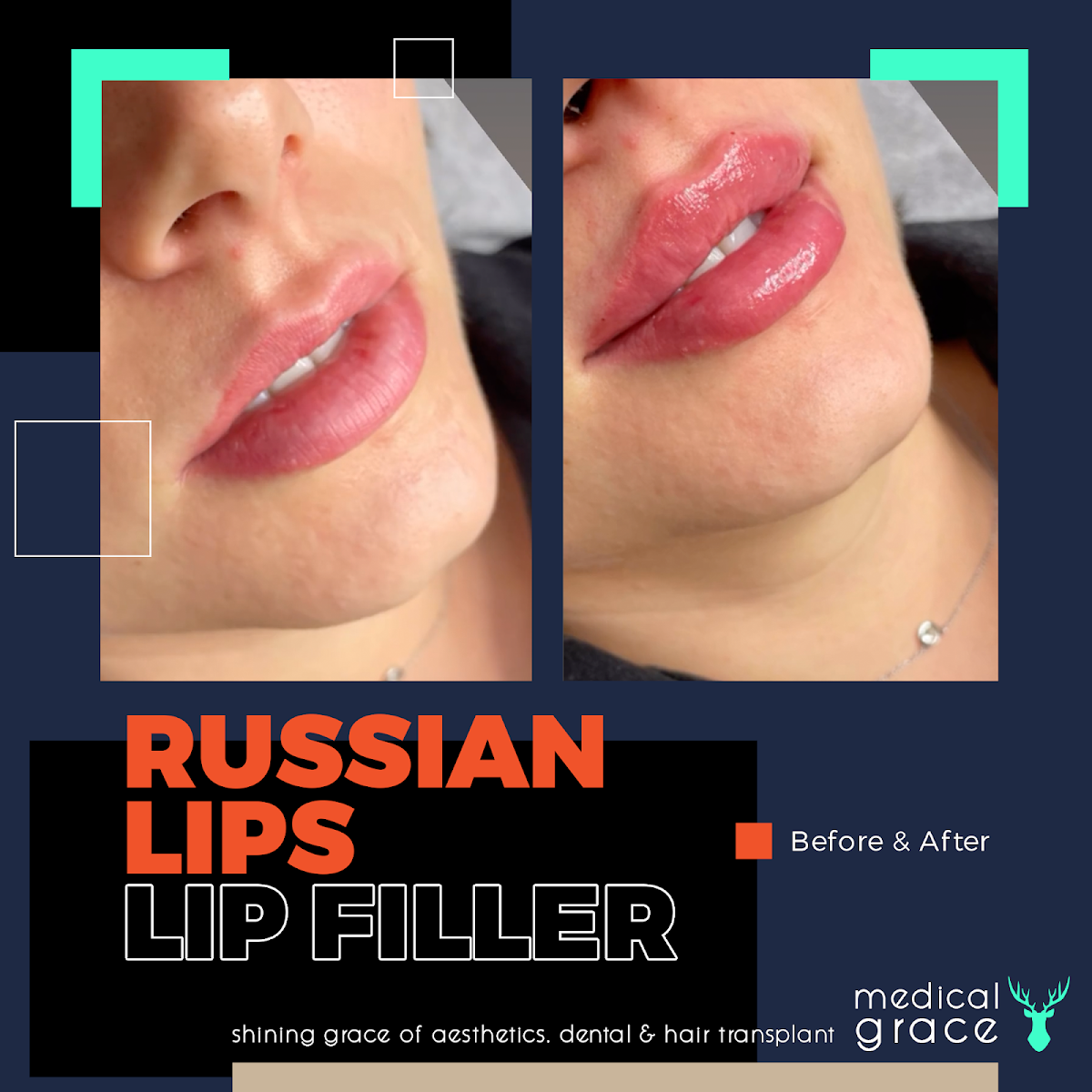 Medical Grace Bodrum Aesthetics — Dr.Visor photo 4