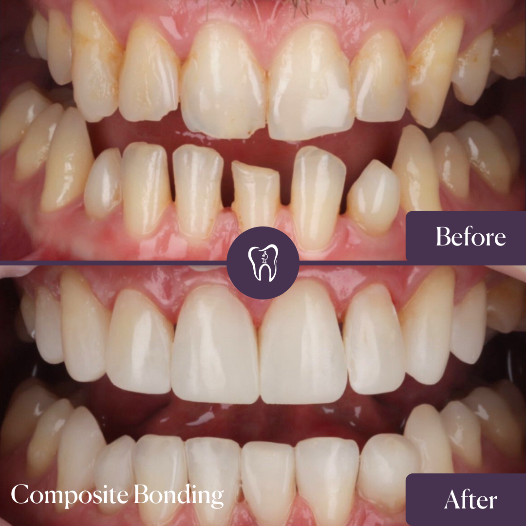 Dame Street Dental Hospital : A Truly Centre Of Excellence — Dr.Visor photo 2
