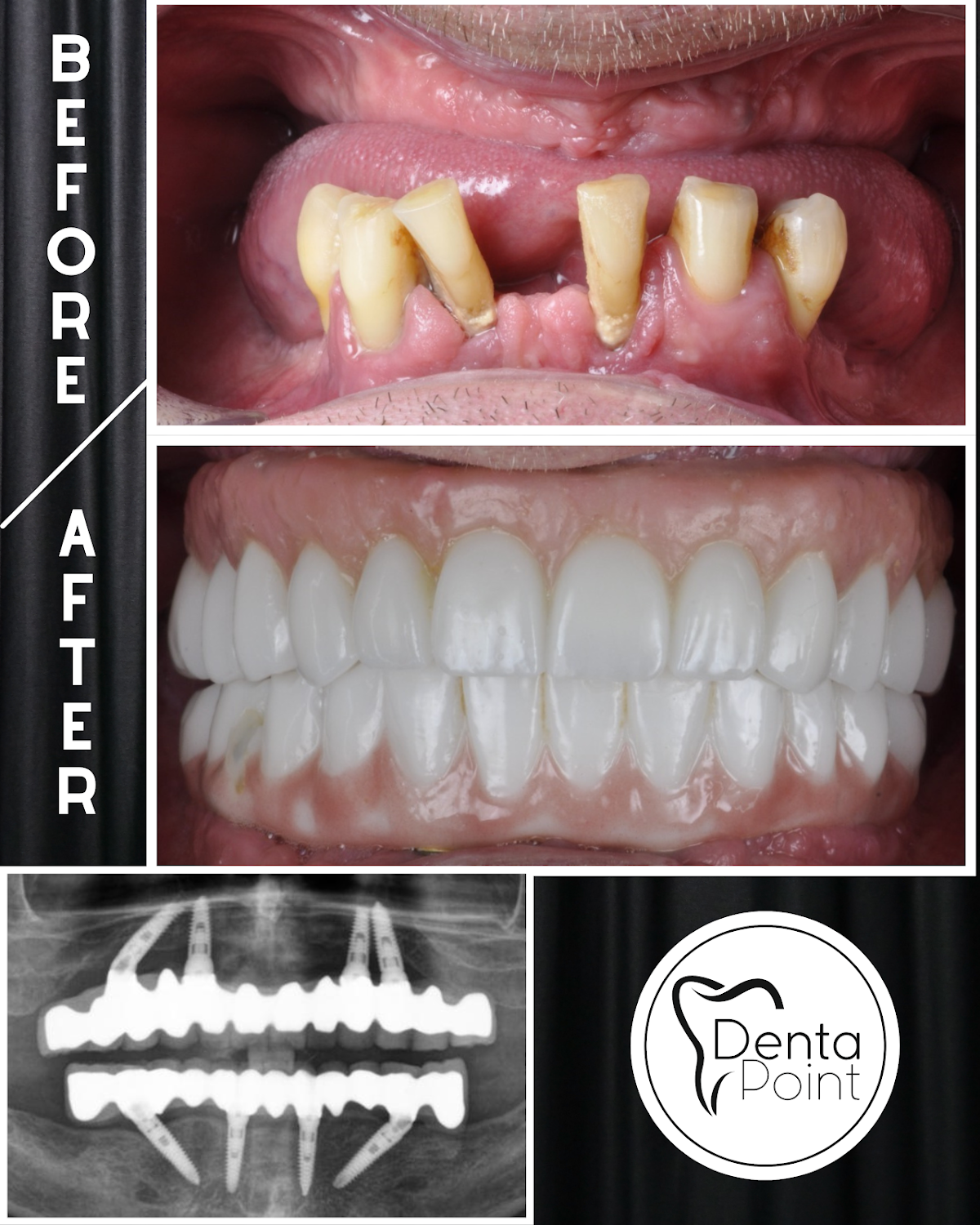 DentaPoint International - Alsancak Şubesi Zirkonyum , Diş İmplantı , Estetik Diş Tedavileri , Çocuk Diş — Dr.Visor photo 2
