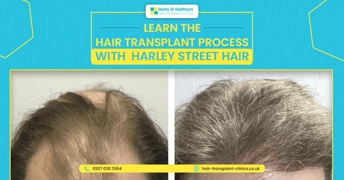 Harley Street Healthcare - Hair Transplant Clinics — Dr.Visor photo 2