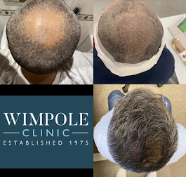 Wimpole Hair Transplant Clinic Leeds — Dr.Visor photo 3