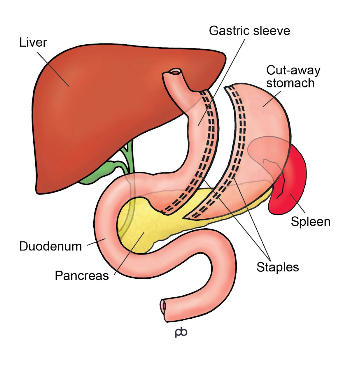 Abeezar Sarela — Dr.Visor photo 5
