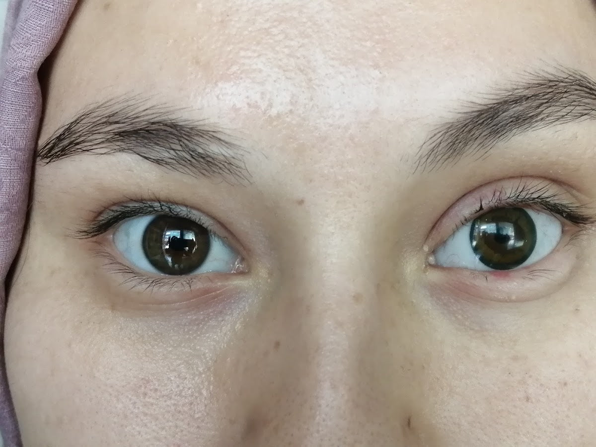 Gizem Protez Göz Merkezi — Dr.Visor photo 5