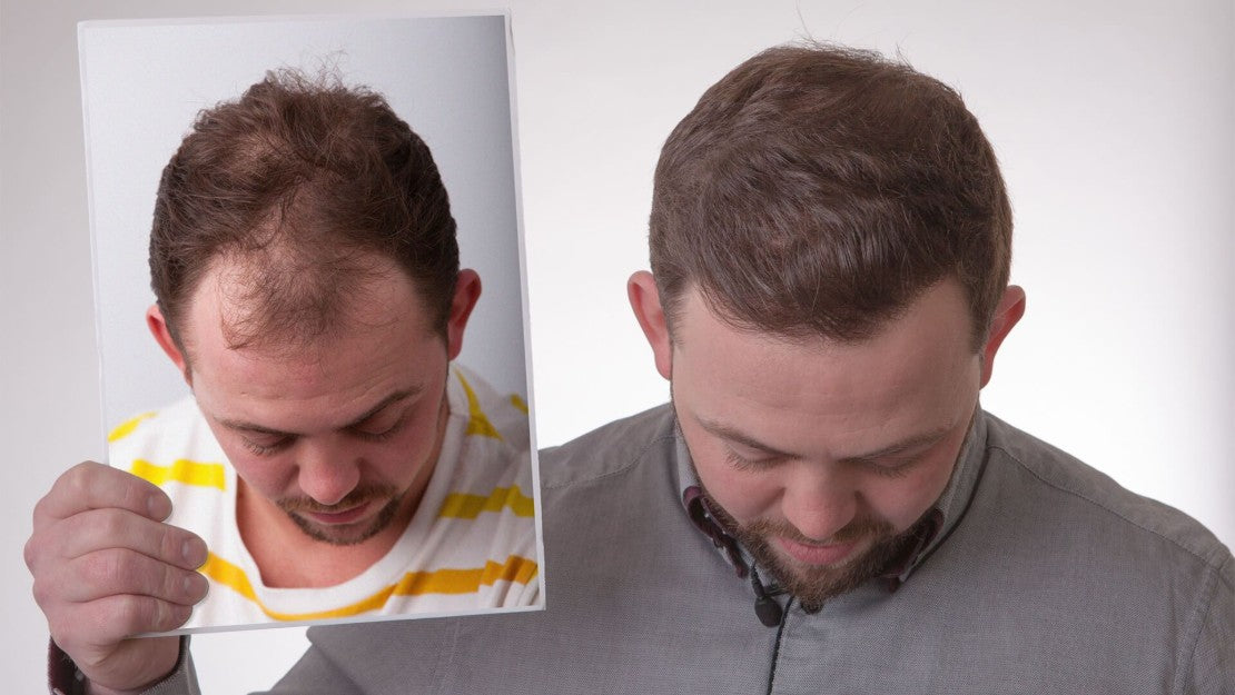 FUE Clinics - Birmingham — Dr.Visor photo 3