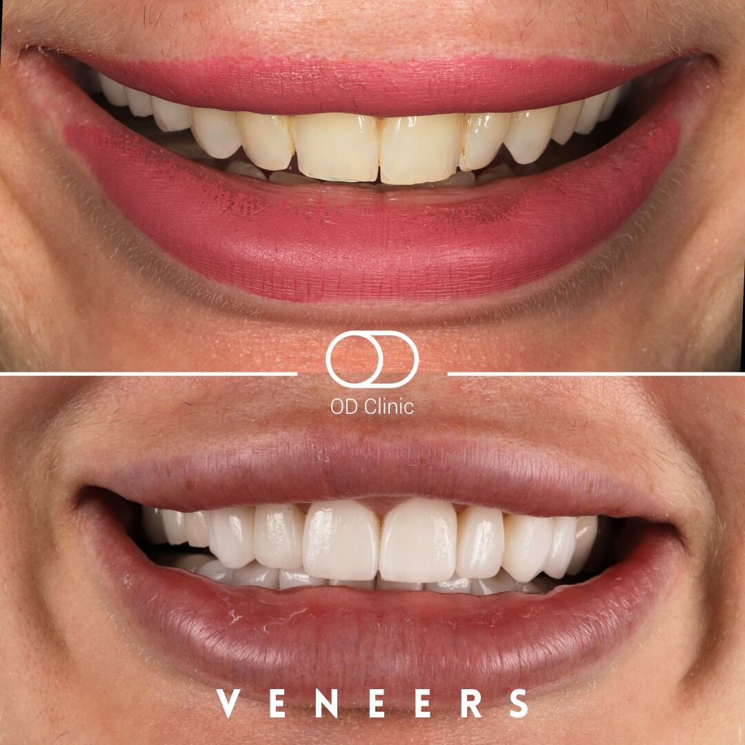 OD Clinic Turkey / Orthodontics and Dental Clinic Alanya — Dr.Visor photo 2