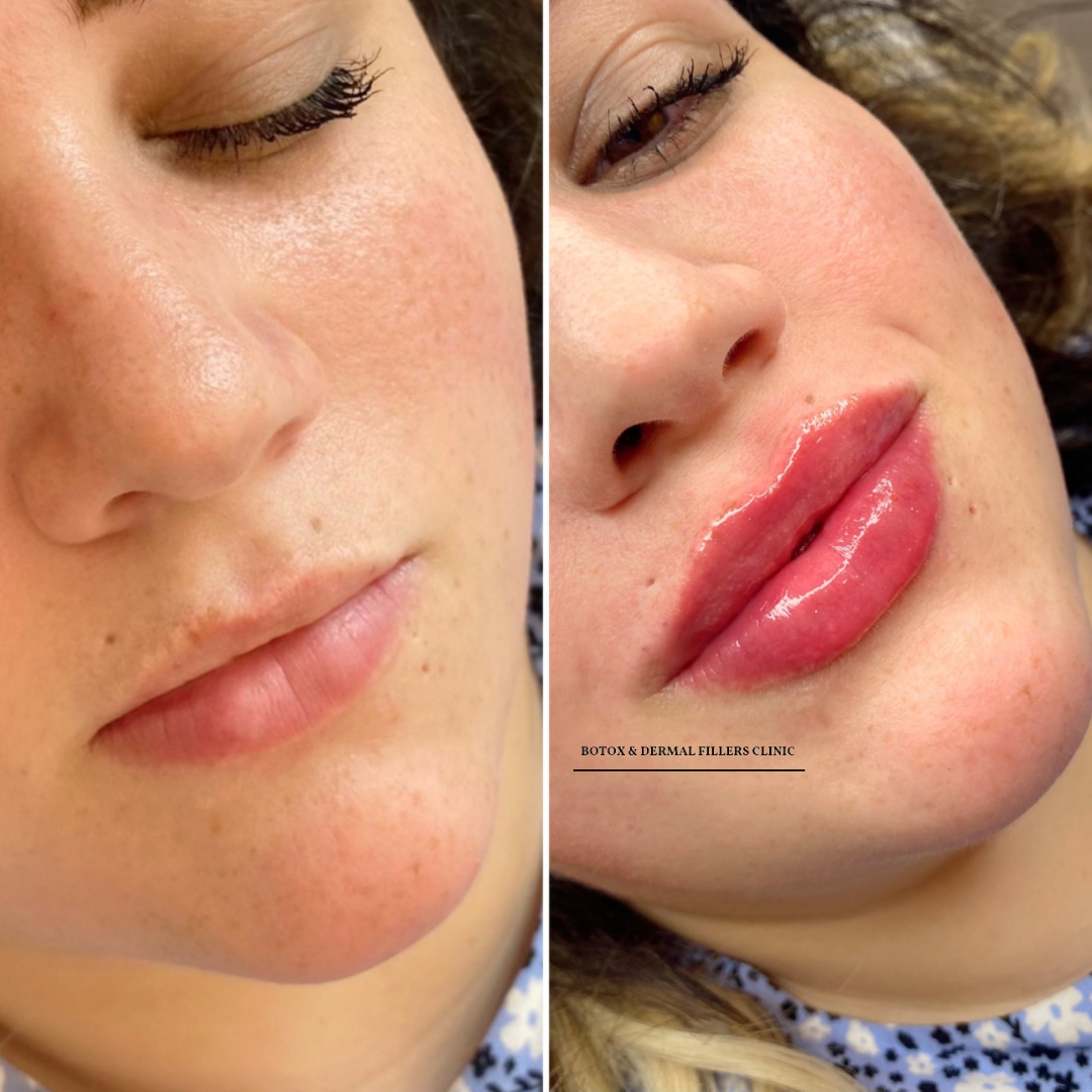 Aesthetics Clinic London — Dr.Visor photo 2