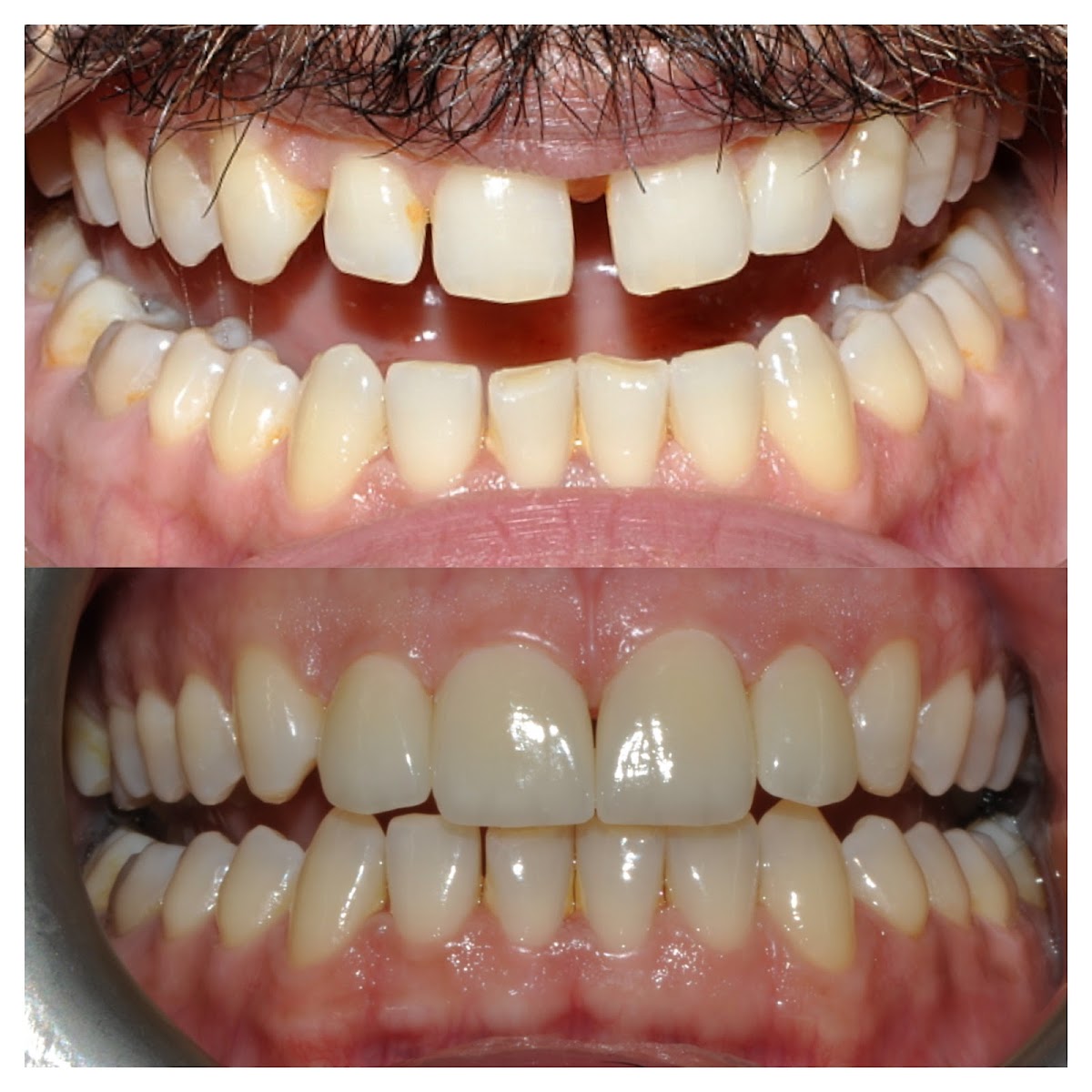 Taksim Dental Clinic — Dr.Visor photo 2