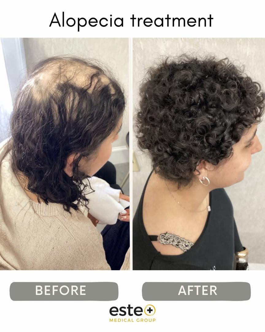 Este Medical - Hair Transplant & Skin Clinic London — Dr.Visor photo 2