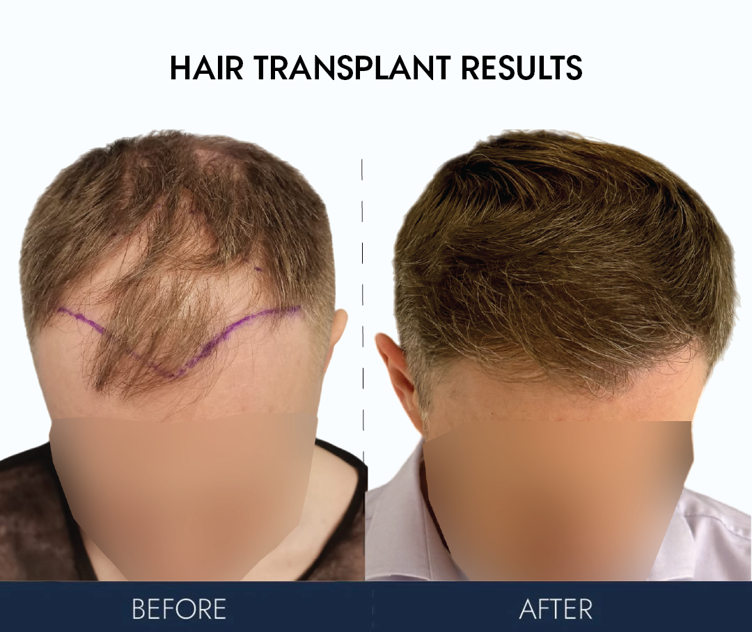 Ailesbury Hair Clinic — Dr.Visor photo 4