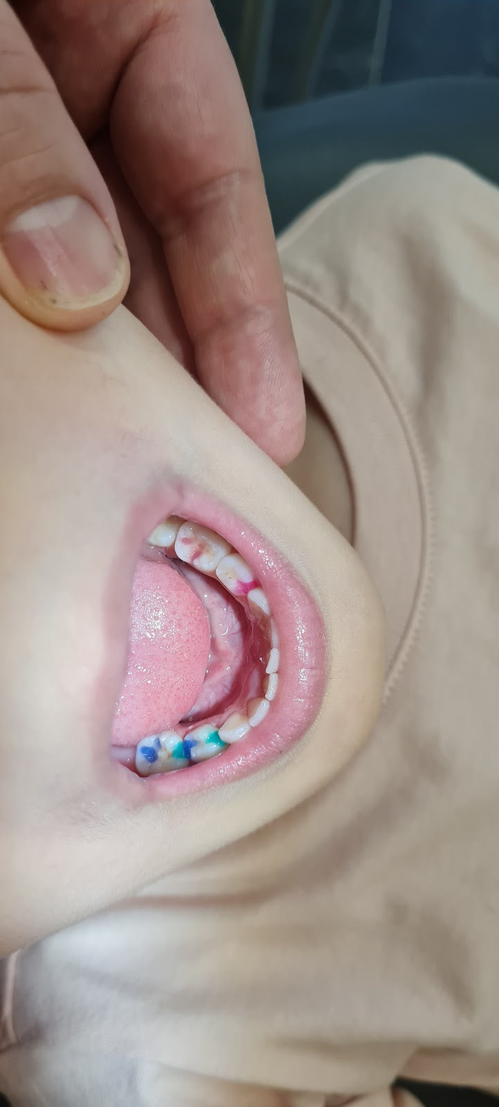 Dental Clinic Academy Ağız ve Diş Sağlığı Polikliniği — Dr.Visor photo 2