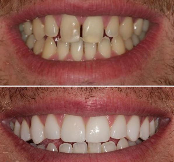 Harley Street Dental Studio — Dr.Visor photo 4