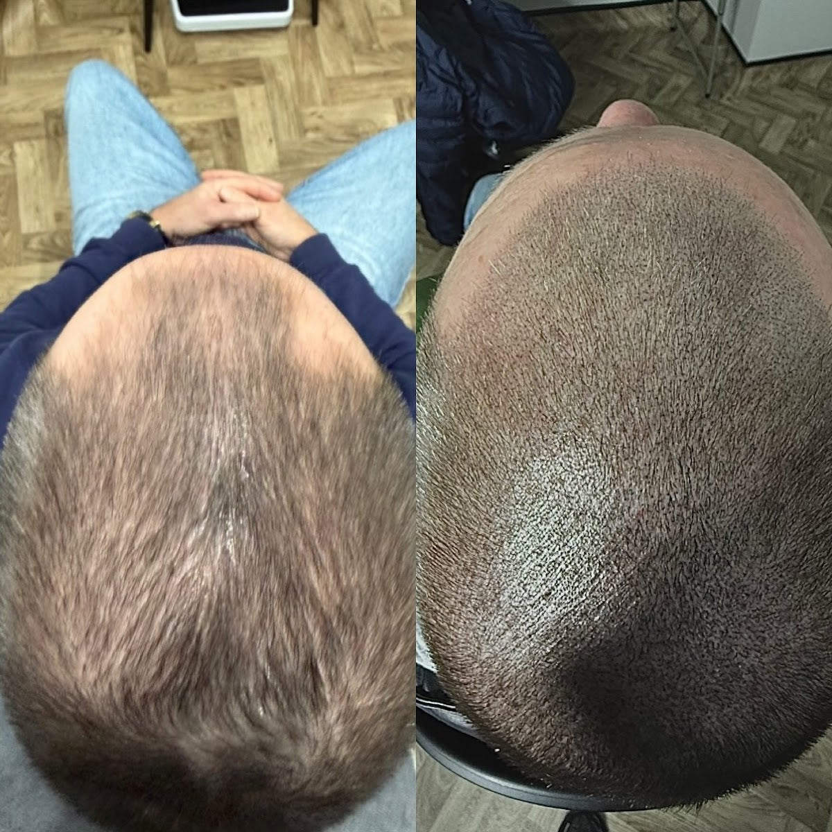 The Hairline Guy — Dr.Visor photo 4