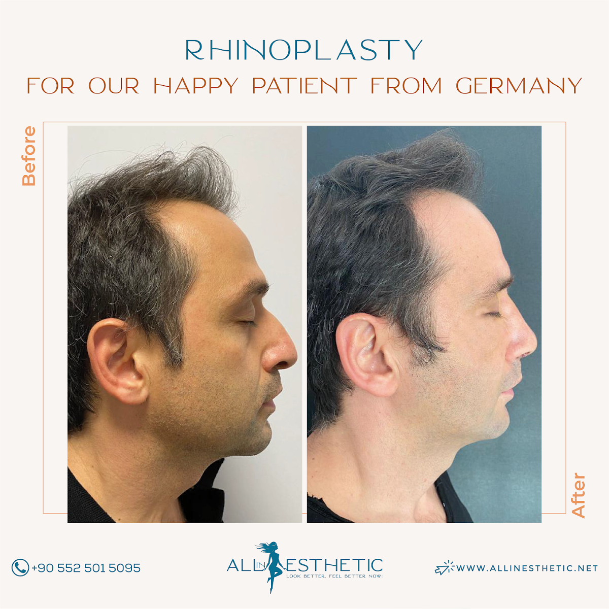 All in Esthetic — Dr.Visor photo 5