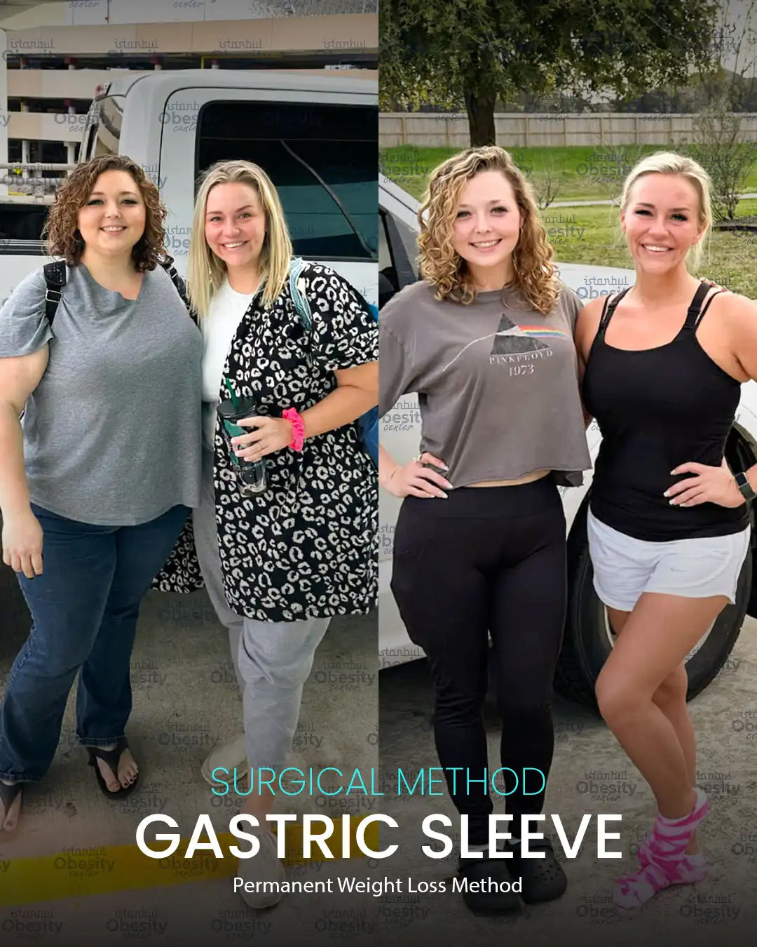 Istanbul Obesity Center | Gastric Sleeve, Gastric Balloon & Bariatric Surgery in Turkey — Dr.Visor photo 5