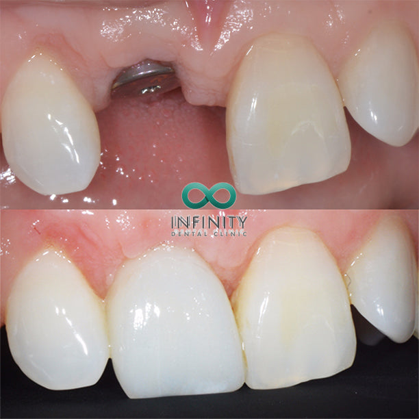 Infinity Dental Clinic — Dr.Visor photo 4