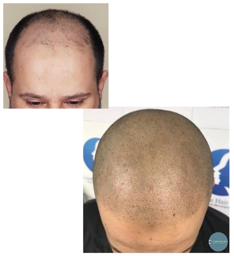 Creative Hair Clinic — Dr.Visor photo 2
