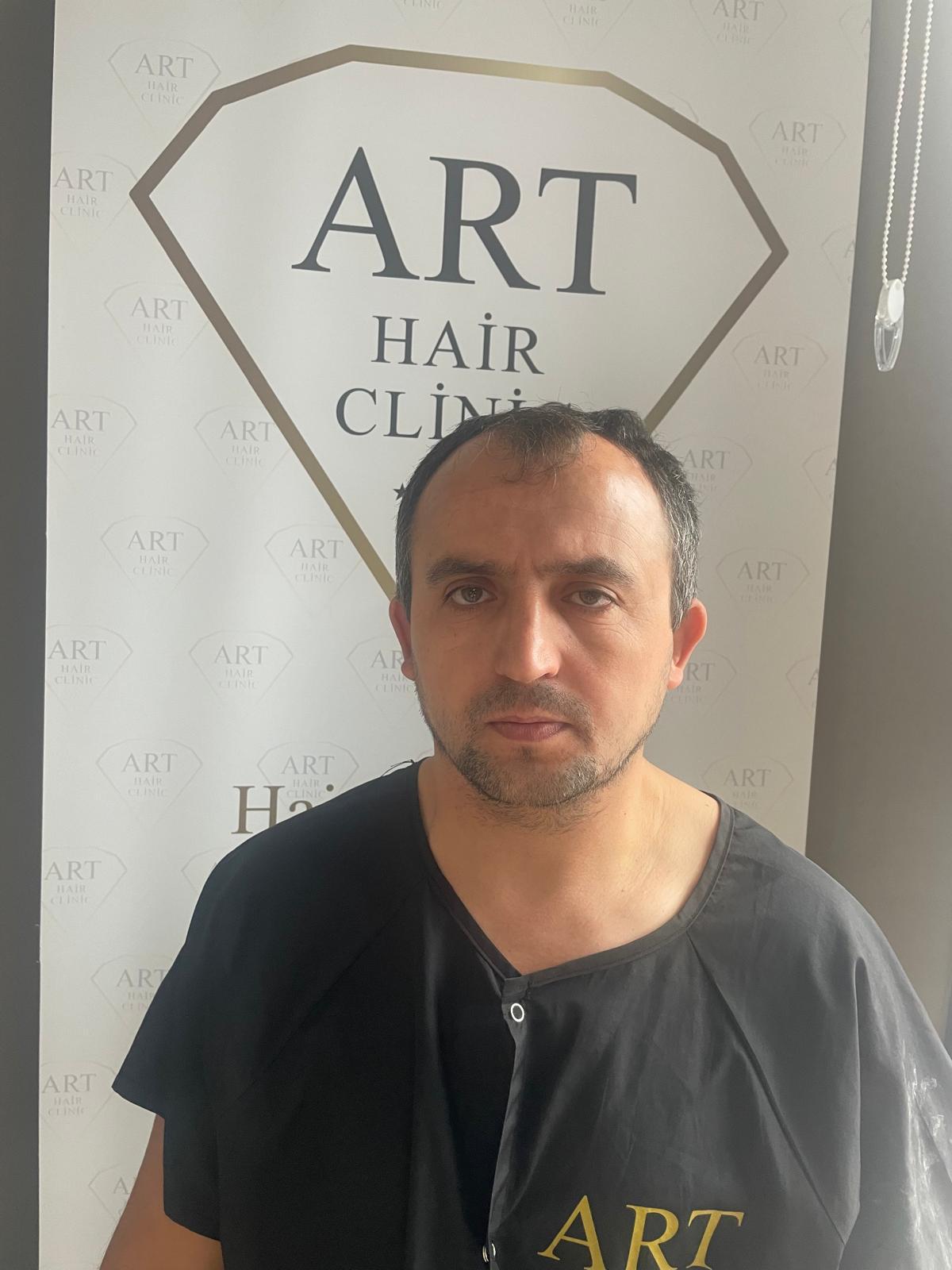 İzmir Saç Ekim Merkezi - Art Hair Clinic — Dr.Visor photo 2