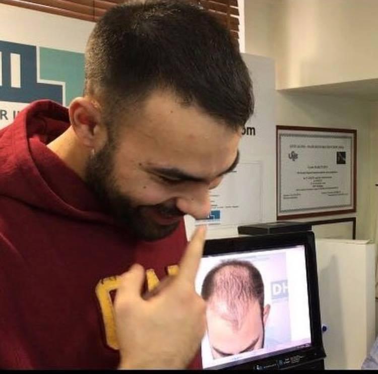 Beacon Hair Restoration Clinic — Dr.Visor photo 5