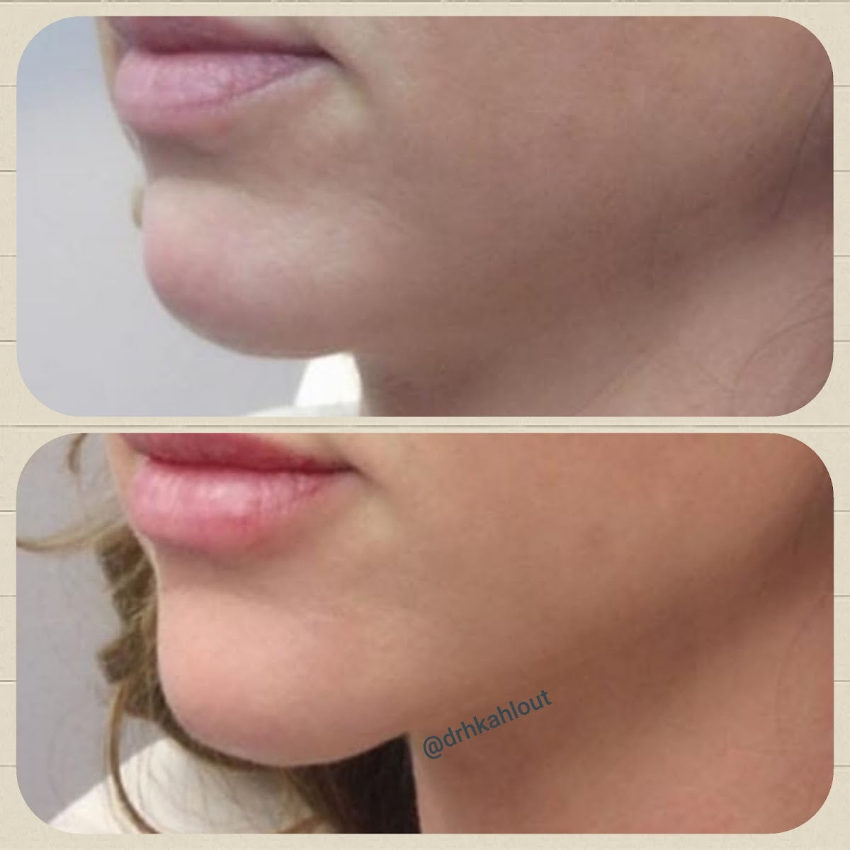 Castleknock Cosmetic Clinic — Dr.Visor photo 5