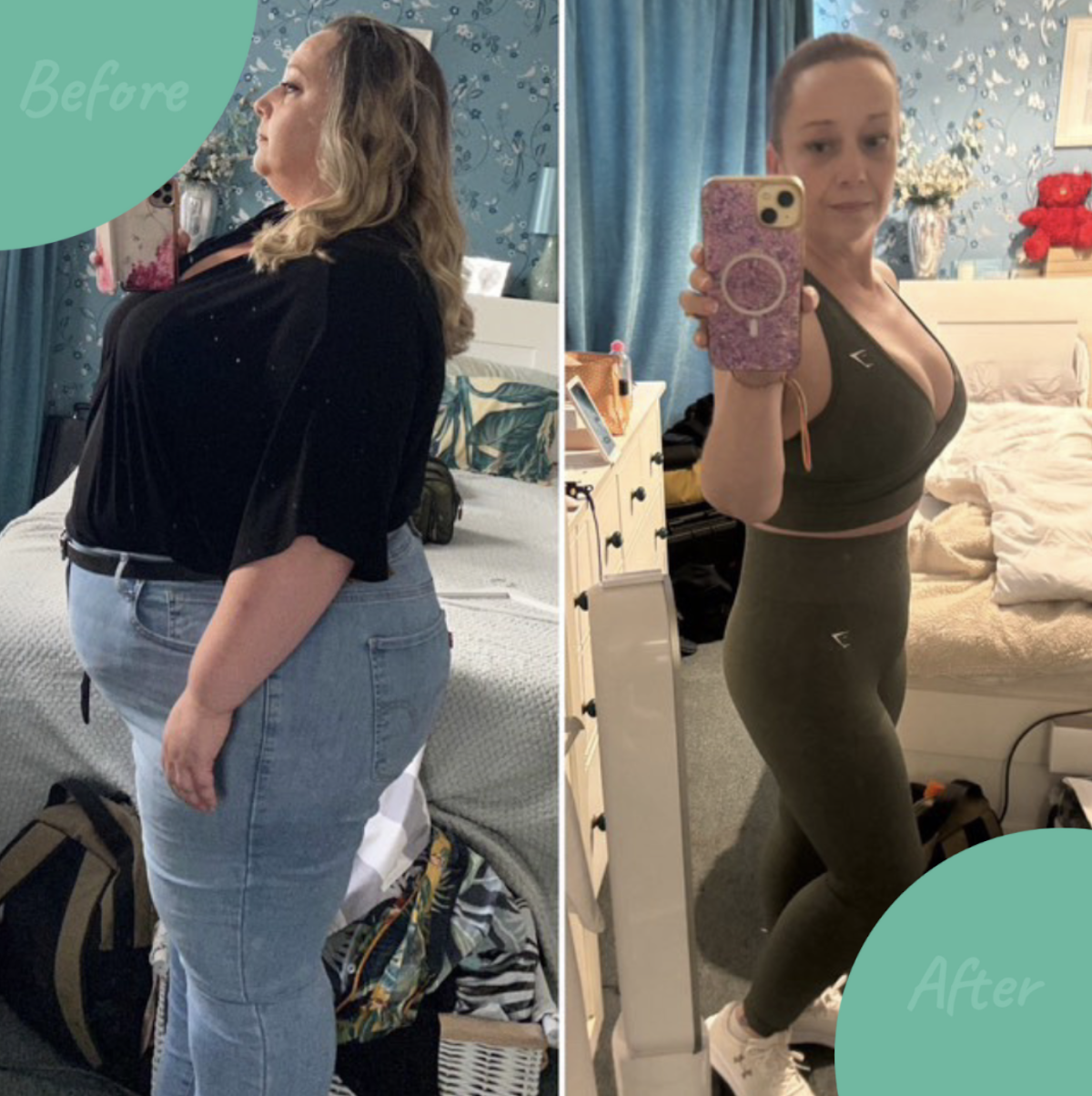 Tonic Weight Loss Surgery — Dr.Visor