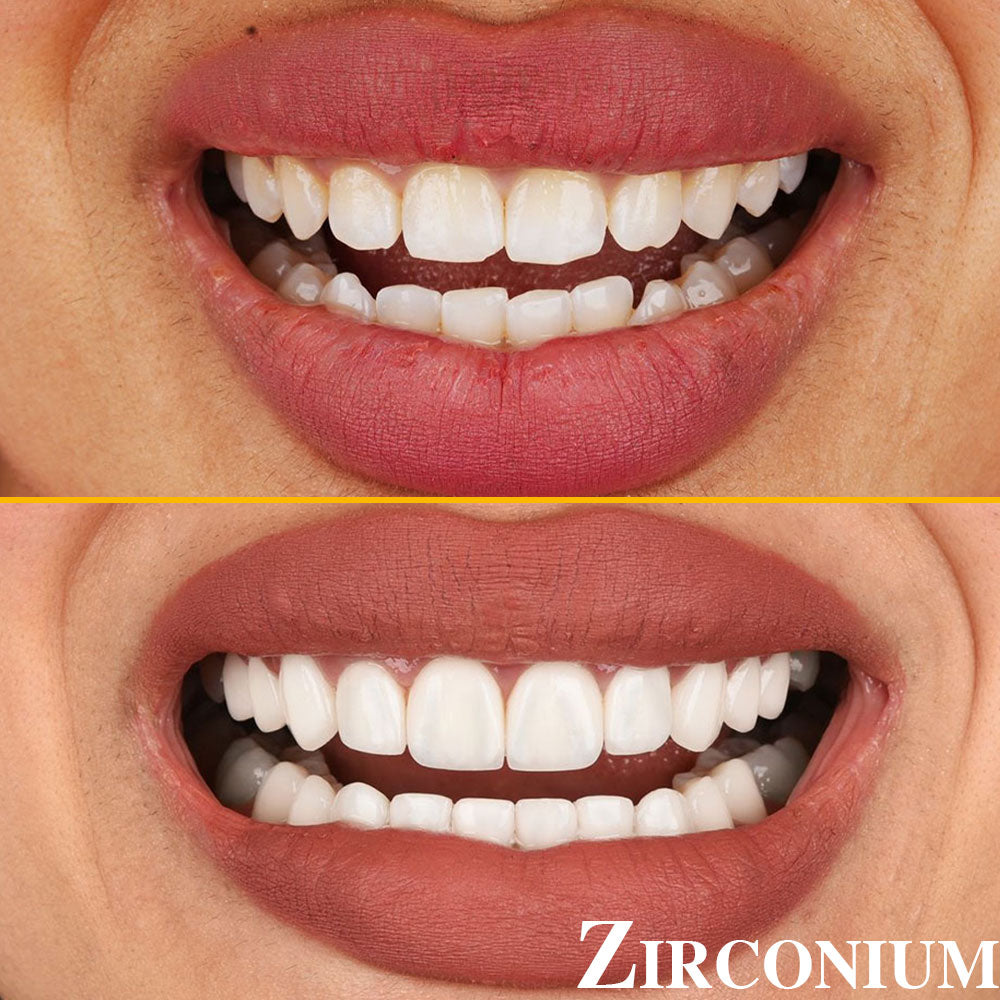 Best Dentist Istanbul | Dental | Hair Transplant | Hospital — Dr.Visor photo 3