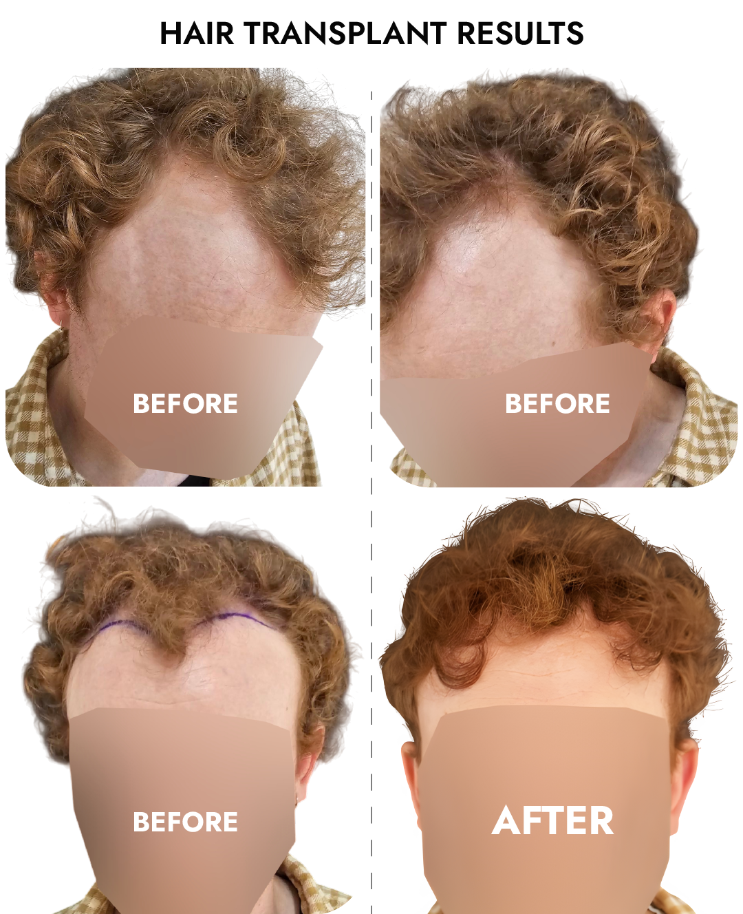 Ailesbury Hair Clinic — Dr.Visor photo 3