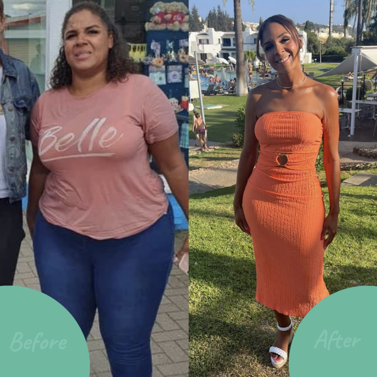 Tonic Weight Loss Surgery — Dr.Visor photo 5