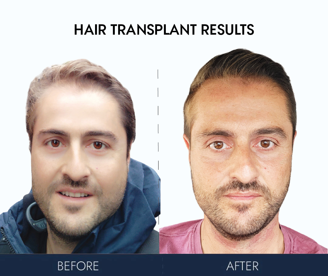 Ailesbury Hair Clinic — Dr.Visor photo 5